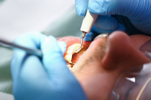 Best Emergency Dental Care for Sports Injuries in Enochville, NC